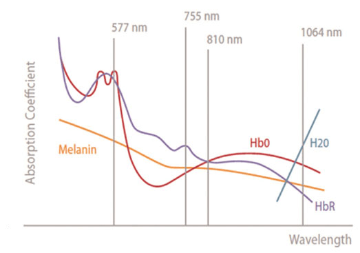 triple wavelength 755nm,808nm,1064nm