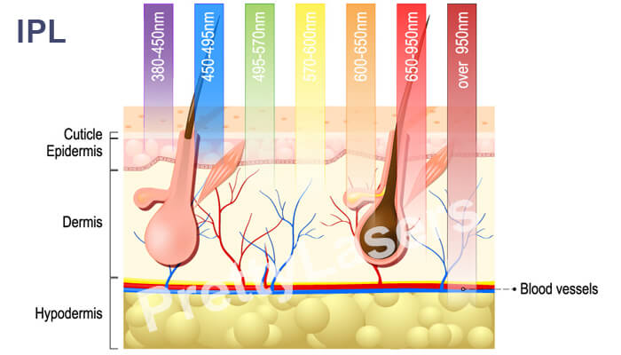 How IPL works?