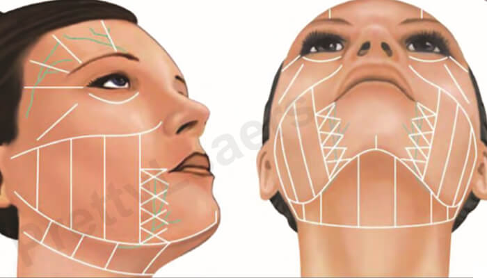 Full Face Mask Line Completion Chart