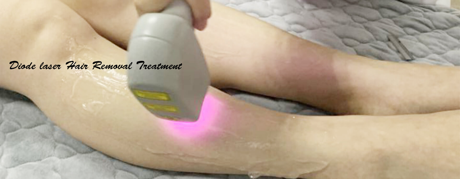 How To Use Laser Hair Removal Machine?