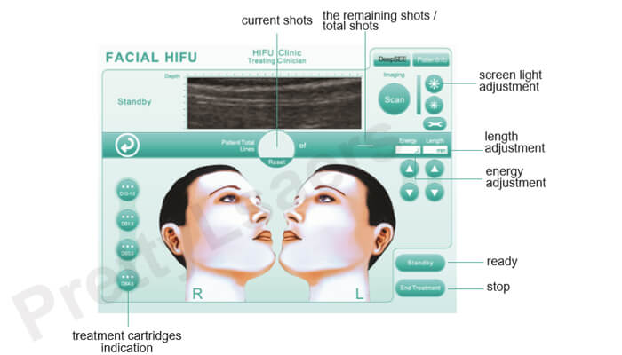 hifu treatment