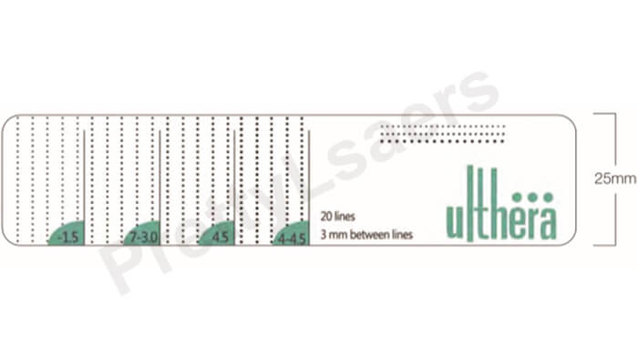 the standard Transducer energy line length 