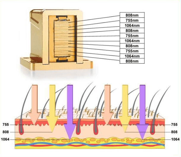 The Best Laser Wavelength-any skin types with 755nm, 808nm & 1064nm wavelengths