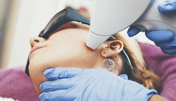 Laser hair removal is safe for all parts of the body, including the face, but a protective eye cover is usually used.