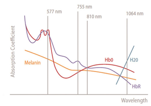 Golden Standard 808nm, Alex 755nm and Long pulse 1064nm wavelength