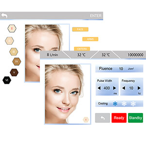 Parameters Setting Interface