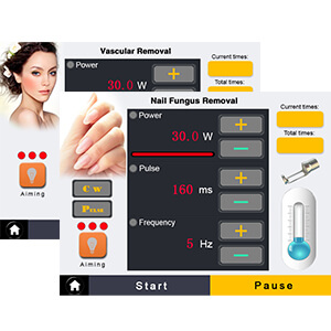 Vascular Removal And Nails Fungus Removal Interface