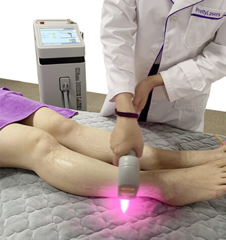 Diode Laser Hair Removal Machine For Sale