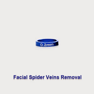 0.2mm Plug For Facial Spider Veins Removal 