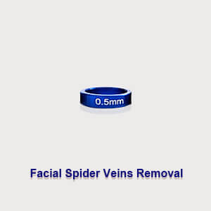 0.5mm Plug For Facial Spider Veins Removal 
