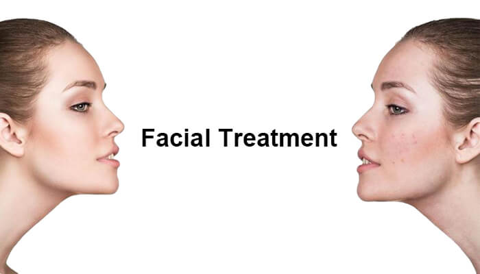 Facial Treatment