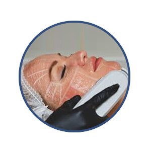 Facial HIFU Treatment