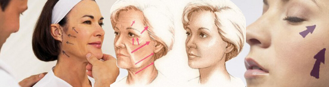 HIFU Treatment Position