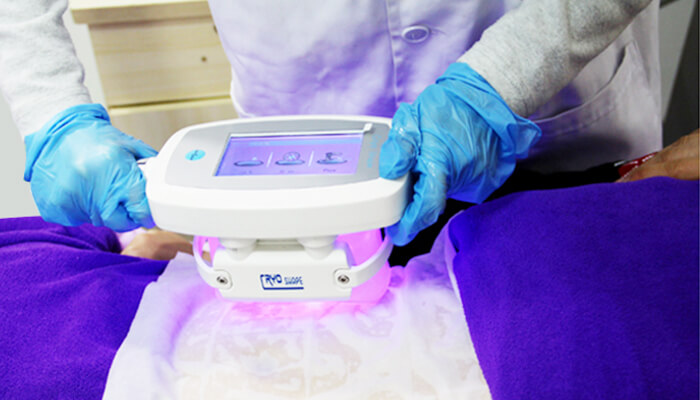 Non-invasive Cryolipolysis Technologies