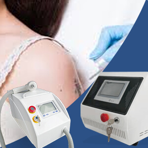 How much is a professional laser tattoo removal machine?
