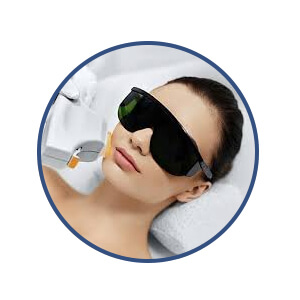 IPL Facial Treatment