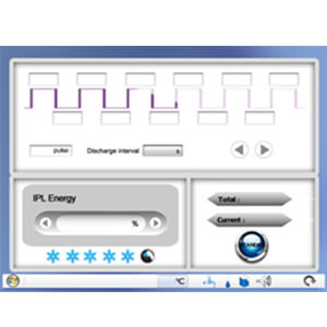 IPL System Parameters Setting Interface IPL System Parameters Setting Interface