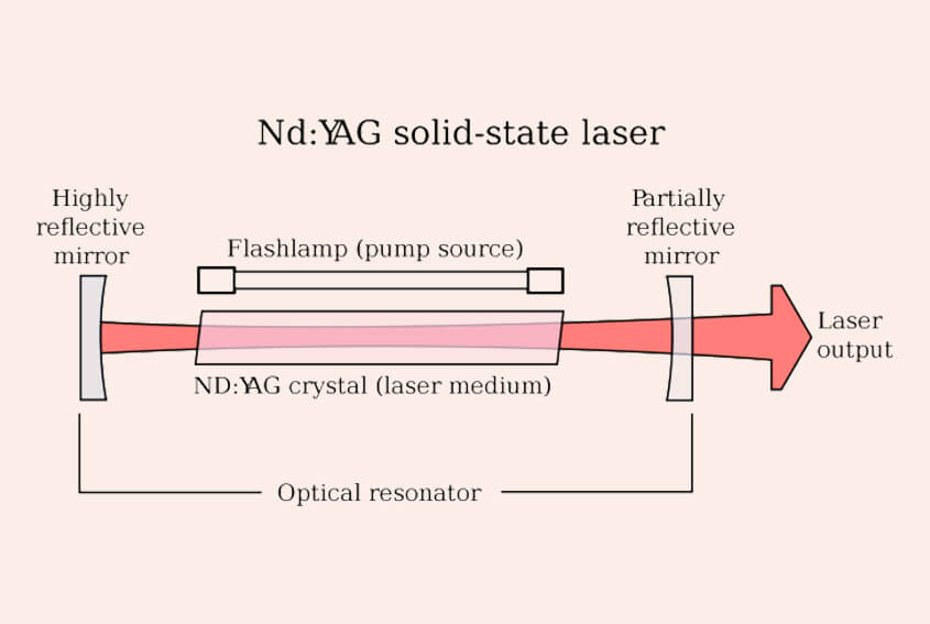 Q-Switched Nd:YAG Lasers for Laser Tattoo Removal Technology