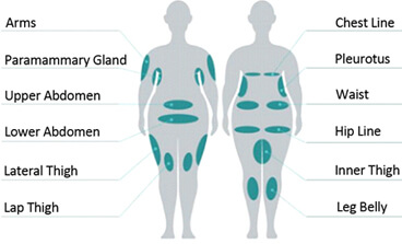 The Narrow Body Part