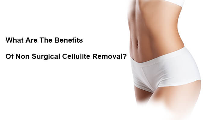 What Are The Benefits Of Non Surgical Cellulite Removal?