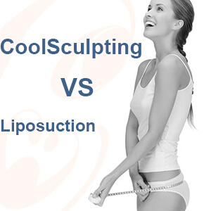 What Is The Difference Between CoolSculpting Vs Liposuction?