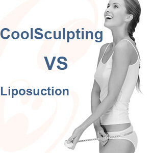 What Is The Difference Between CoolSculpting Vs Liposuction?