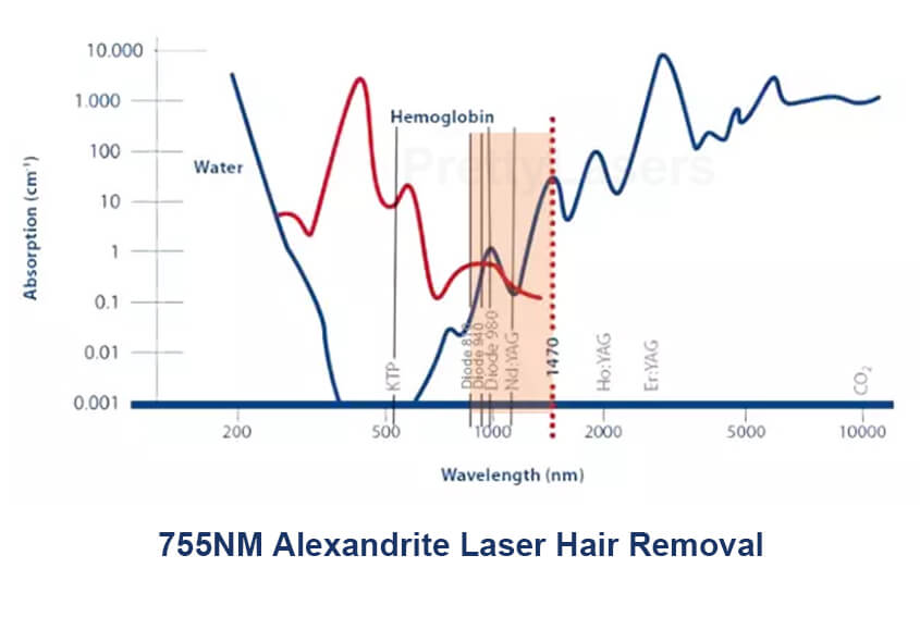 Why Choose Alexandrite Laser Hair Removal 755nm?