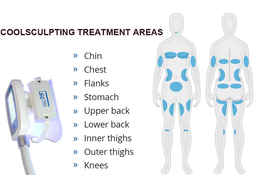 CoolSculpting Treatment Areas