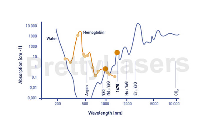 980nm laser is the optimum absorption spectrum of Porphyrin vascular cells. 