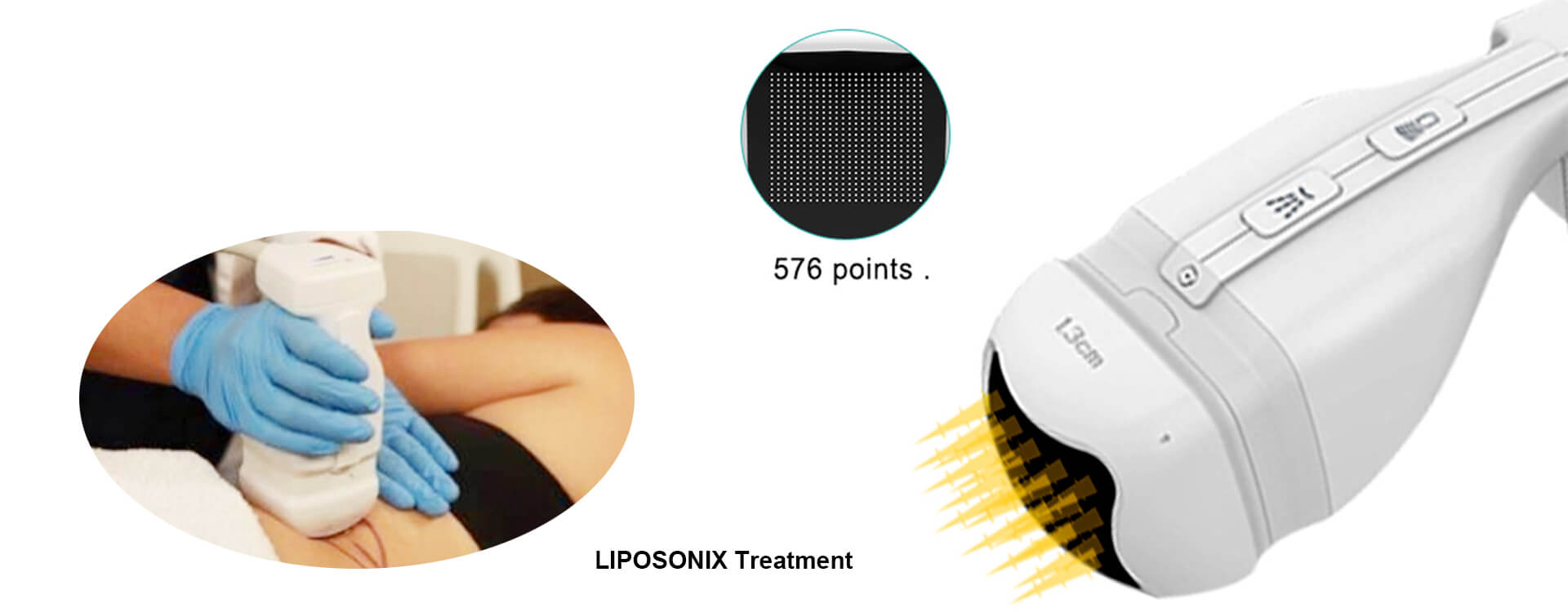 What Is The Operation Guides Of Liposonix?