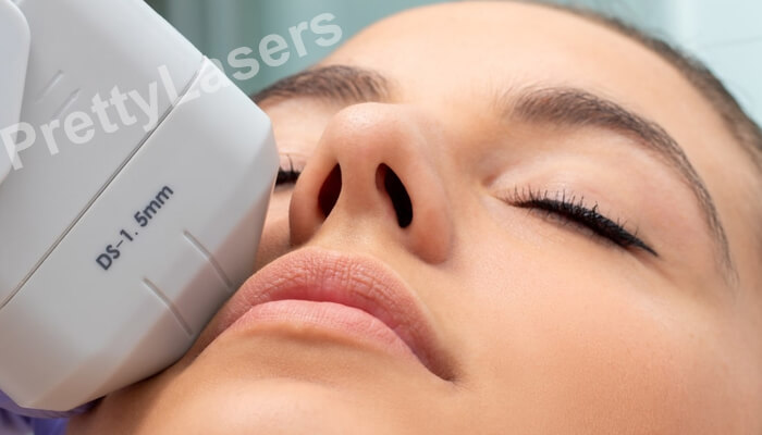 a nonsurgical skin tightening 