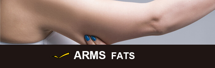 Cost of CoolSculpting for arms