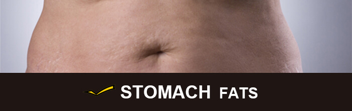 Cost of CoolSculpting for stomach