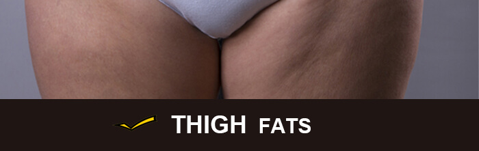 Cost of CoolSculpting for thighs