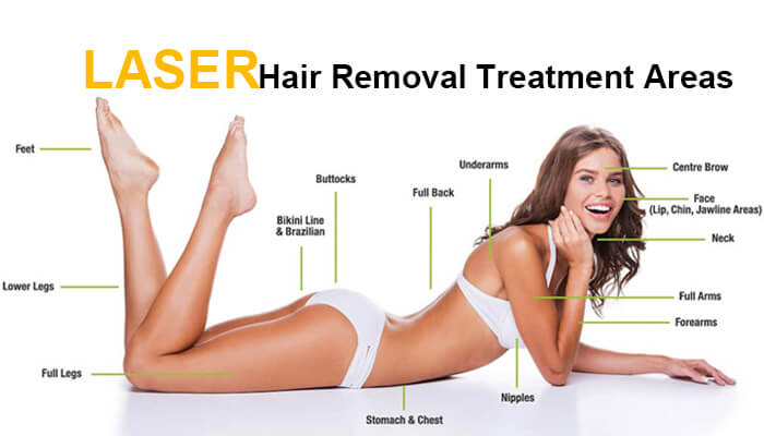 Which areas can be treated by laser hair removal machine for business?