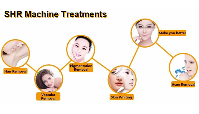 SHR Machine Treatments