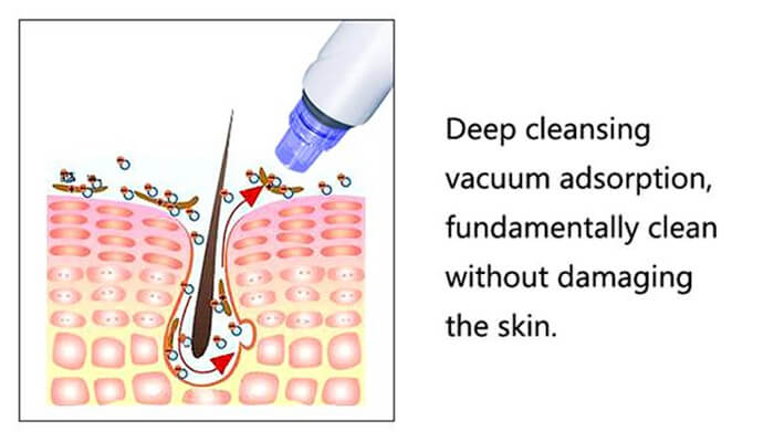 How does hydra dermabrasion machine work?