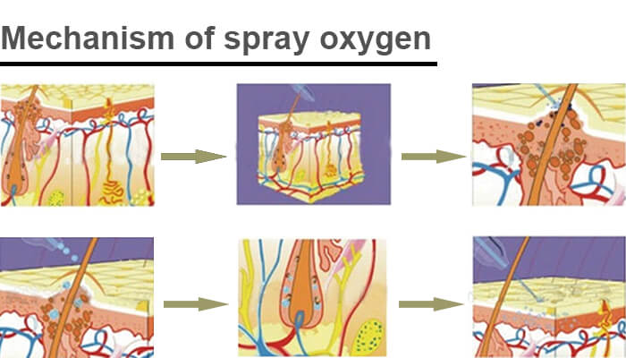 Mechanism of spray oxygen