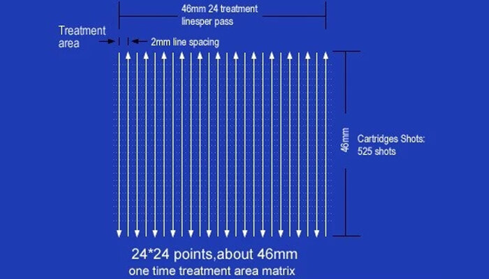 One Time Treatment Area Matrix