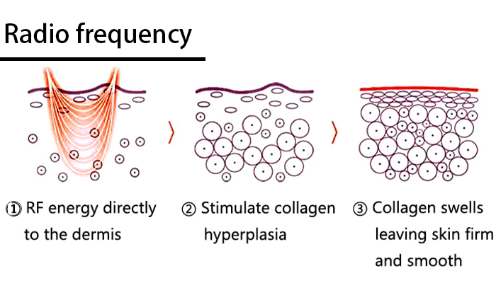 Radio frequency