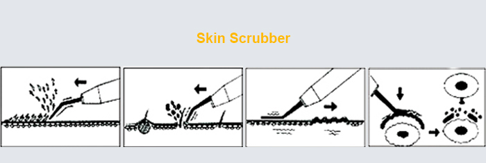 Skin scrubber