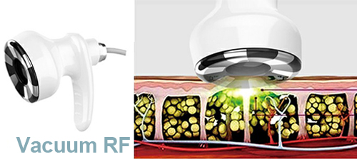 Vacuum RF