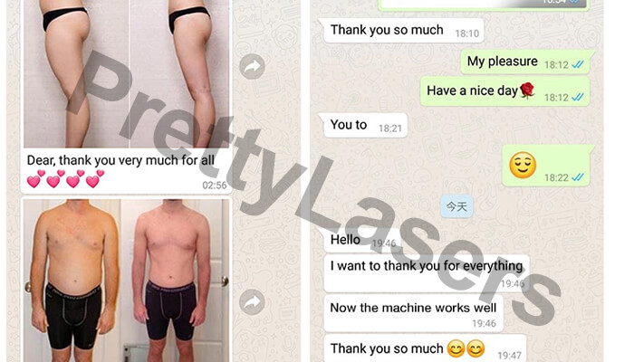 cryolipolysis machine customer feedback