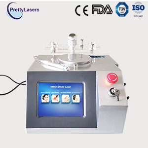 Laser Removal Spider Veins Machine Cost