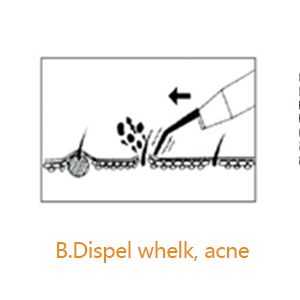 Dispel whelk, acne