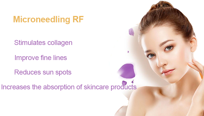 RF Microneedling Treatment