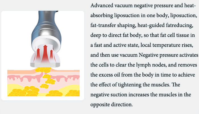  vacuum negative pressure