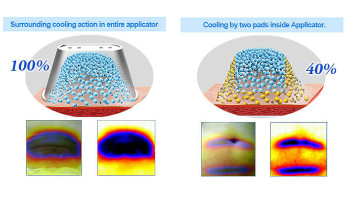360 Degree Surrounding Cooling Applicator 360 Degree Surrounding Cooling Applicator