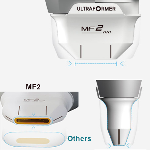 Patent 2.0 mm Cartridge - MF2