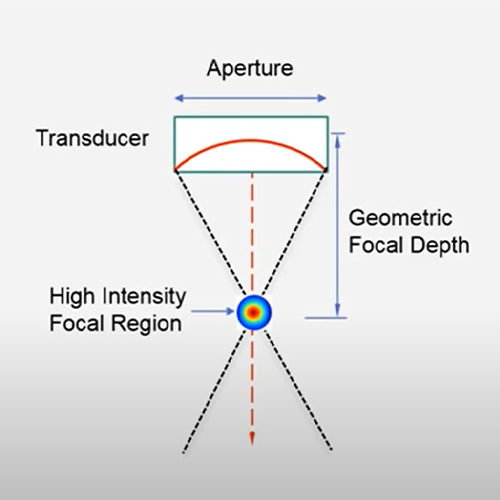 MMFU (Macro & Micro Focused Ultrasound) Technology